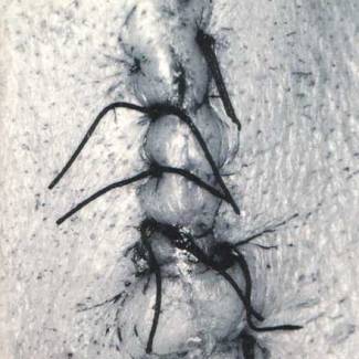 Infliction